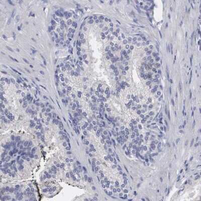 Immunohistochemistry-Paraffin: HO-1/HMOX1/HSP32 Antibody [NBP1-89964]
