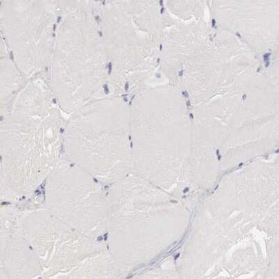 Immunohistochemistry-Paraffin: HO-1/HMOX1/HSP32 Antibody [NBP1-89964]