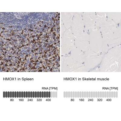 Immunohistochemistry-Paraffin: HO-1/HMOX1/HSP32 Antibody [NBP1-89964]