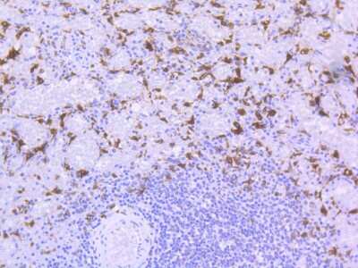 Immunohistochemistry-Paraffin: HO-1/HMOX1/HSP32 Antibody (SP08-07) [NBP2-67382]