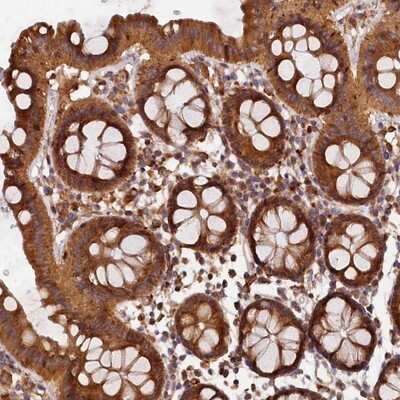 Immunohistochemistry-Paraffin: HO-2/HMOX2 Antibody [NBP1-91981]