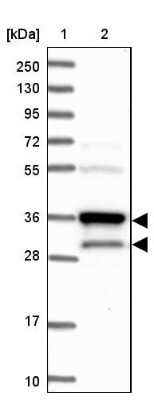 Western Blot: HO-2/HMOX2 Antibody [NBP1-91981]