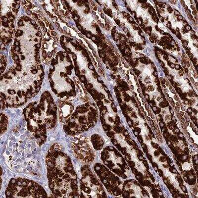 Immunohistochemistry-Paraffin: HOGA1 Antibody [NBP2-14097]