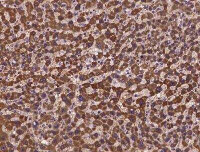 Immunohistochemistry-Paraffin: HOGA1 Antibody [NBP3-06562]