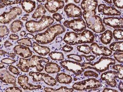 Immunohistochemistry-Paraffin: HOGA1 Antibody [NBP3-06562]