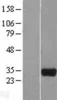 Western Blot: HOGA1 Overexpression Lysate [NBL1-08084]