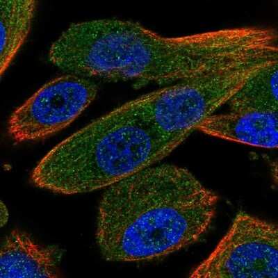 Immunocytochemistry/ Immunofluorescence: HOIP/RNF31 Antibody [NBP2-48914]