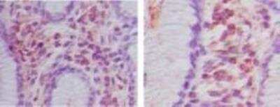 Immunohistochemistry: HOIP/RNF31 Antibody [NBP2-27290]