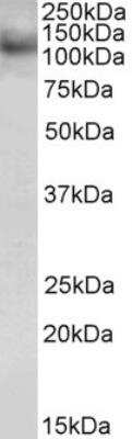 Western Blot: HOIP/RNF31 Antibody [NB100-1094]