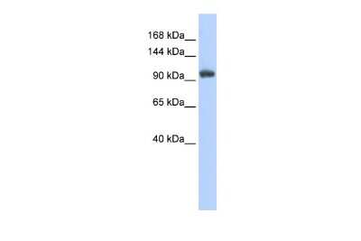 Western Blot: HOIP/RNF31 Antibody [NBP1-55059]