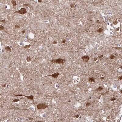 Immunohistochemistry-Paraffin: HOMER1 Antibody [NBP2-38309]