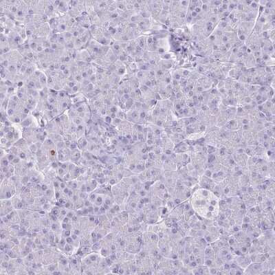 Immunohistochemistry-Paraffin: HOMER1 Antibody [NBP2-38308]