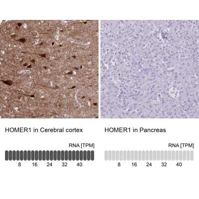 Immunohistochemistry-Paraffin: HOMER1 Antibody [NBP2-38308]