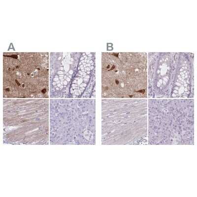 Immunohistochemistry-Paraffin: HOMER1 Antibody [NBP2-38308]