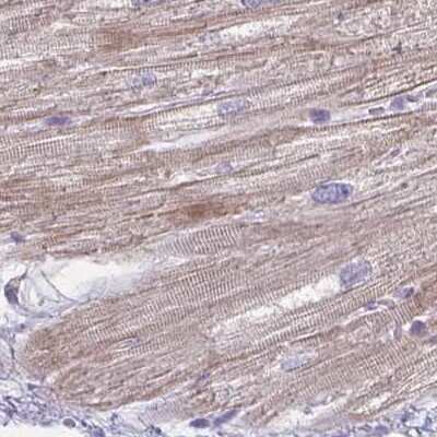 Immunohistochemistry-Paraffin: HOMER1 Antibody [NBP2-38308]