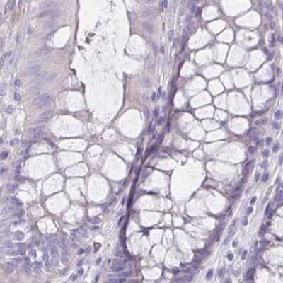 Immunohistochemistry-Paraffin: HOMER1 Antibody [NBP2-38308]