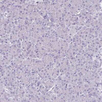 Immunohistochemistry-Paraffin: HOMER1 Antibody [NBP2-38309]