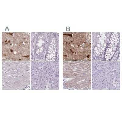 Immunohistochemistry-Paraffin: HOMER1 Antibody [NBP2-38309]