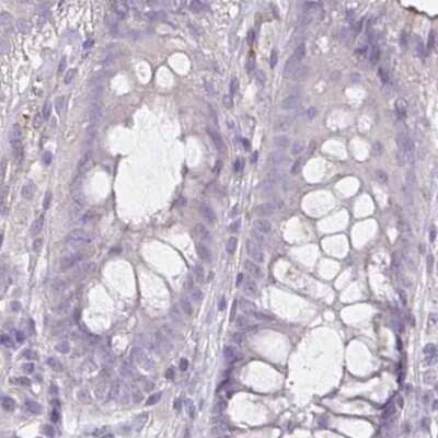 Immunohistochemistry-Paraffin: HOMER1 Antibody [NBP2-38309]