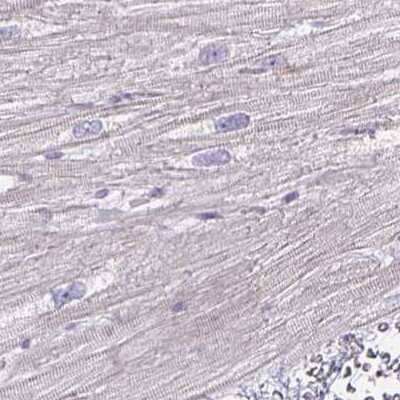 Immunohistochemistry-Paraffin: HOMER1 Antibody [NBP2-38309]