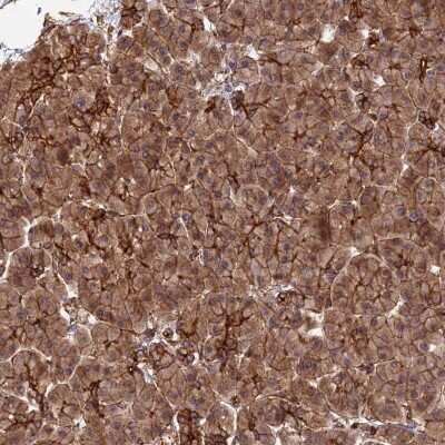 Immunohistochemistry-Paraffin: HOMER2 Antibody [NBP1-85487]