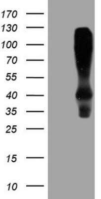 Western Blot: HOMER2 Antibody (OTI1H3)Azide and BSA Free [NBP2-71465]