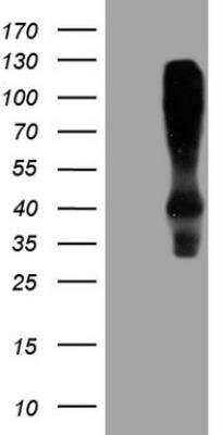 Western Blot: HOMER2 Antibody (OTI1H3) [NBP2-45993]