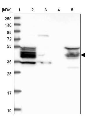 Western Blot: HOMER2 Antibody [NBP1-85487]