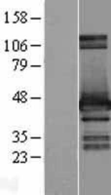 Western Blot: HOMER2 Overexpression Lysate [NBL1-11656]