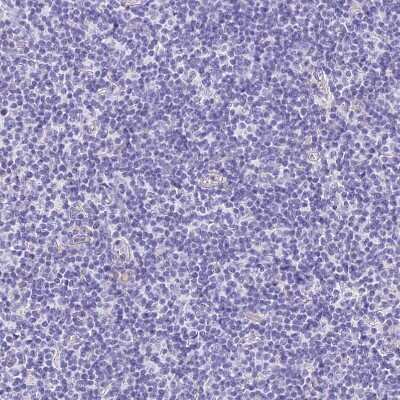 Immunohistochemistry-Paraffin: HOMER3 Antibody [NBP2-32607]