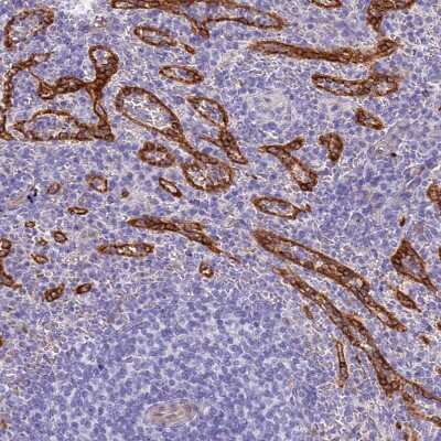 Immunohistochemistry-Paraffin: HOMER3 Antibody [NBP2-32607]