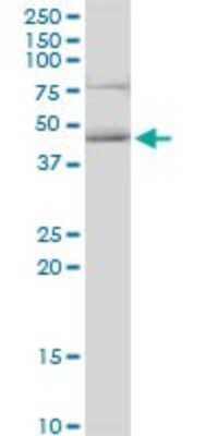 Western Blot: HOMER3 Antibody [H00009454-B01P]