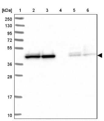 Western Blot: HOMER3 Antibody [NBP2-32607]