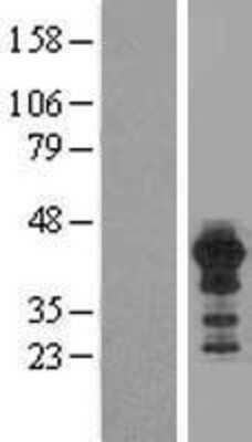 Western Blot: HOMER3 Overexpression Lysate [NBL1-11657]