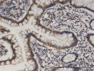 Immunohistochemistry-Paraffin: HOOK1 Antibody (1D11) [H00051361-M02]