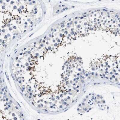 Immunohistochemistry-Paraffin: HOOK1 Antibody [NBP1-81745]