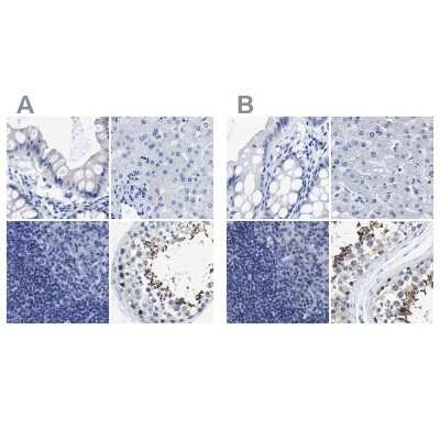 Immunohistochemistry-Paraffin: HOOK1 Antibody [NBP1-81745]