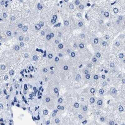 Immunohistochemistry-Paraffin: HOOK1 Antibody [NBP1-81745]