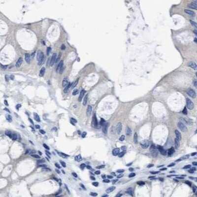 Immunohistochemistry-Paraffin: HOOK1 Antibody [NBP1-81745]