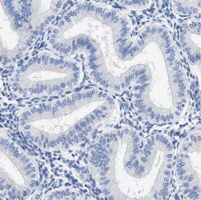 Immunohistochemistry-Paraffin: HOOK1 Antibody [NBP1-81745]
