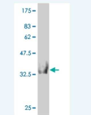 Western Blot: HOOK2 Antibody (1E10) [H00029911-M03]