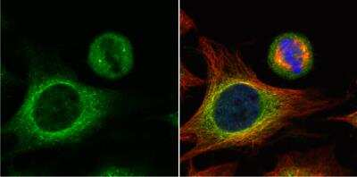 Immunocytochemistry/ Immunofluorescence: HOOK2 Antibody [NBP2-14986]