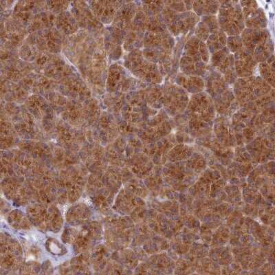 Immunohistochemistry: HOOK2 Antibody [NBP2-47429]