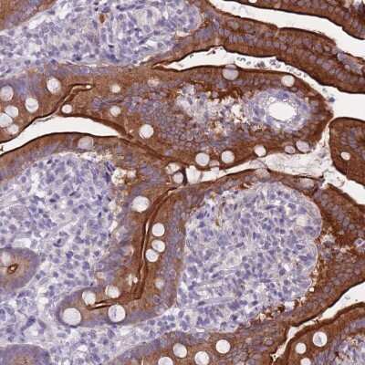 Immunohistochemistry: HOOK2 Antibody [NBP2-47430]