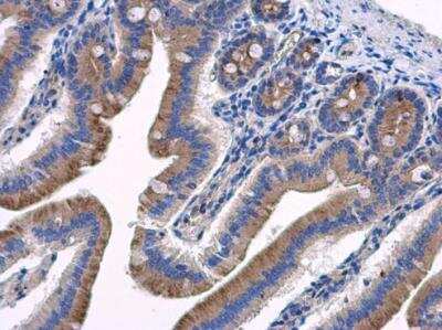 Immunohistochemistry-Paraffin: HOOK2 Antibody [NBP2-14986]