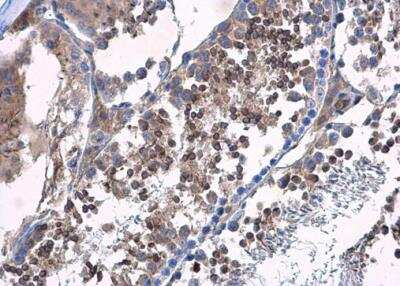Immunohistochemistry-Paraffin: HOOK2 Antibody [NBP2-14986]