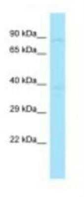 Western Blot: HOOK2 Antibody [NBP1-98586]