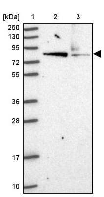 Western Blot: HOOK2 Antibody [NBP2-47430]