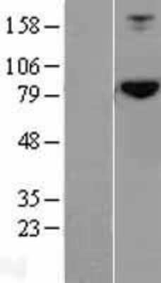 Western Blot: HOOK2 Overexpression Lysate [NBL1-11659]