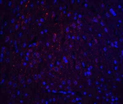 Immunocytochemistry/ Immunofluorescence: HOOK3 Antibody - BSA Free [NBP2-81990]